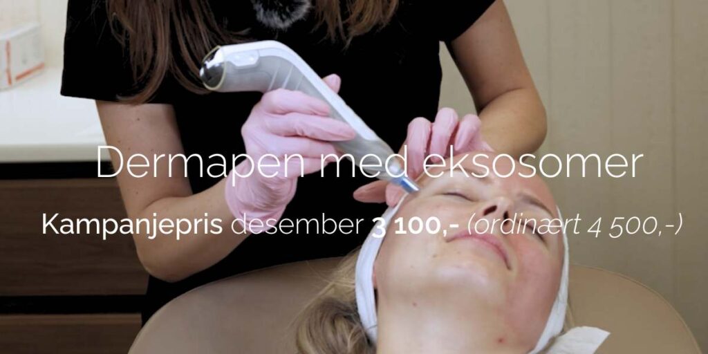 Dermapen med eksosomer