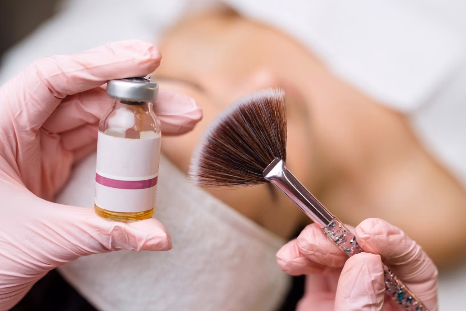Nærbilde av kjemisk peeling, peeling med syrer