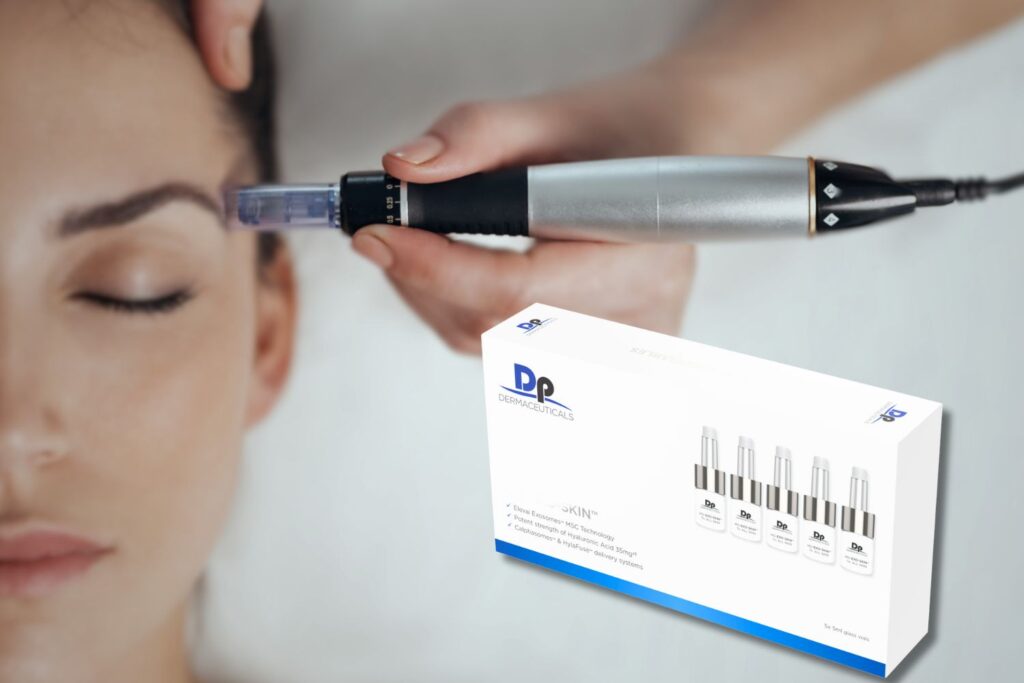 Bildet viser en dermapenbehandling med eksosomer