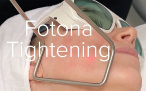 FOTONA TIGHTENING