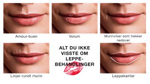 Alt du ikke visste om leppe fillers