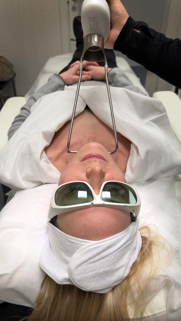 Kvinne som får Fotona 4D laser behandling på hals