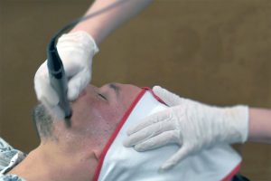 Mann i trettiårene som blir behandlet med Dermapen - microneedling