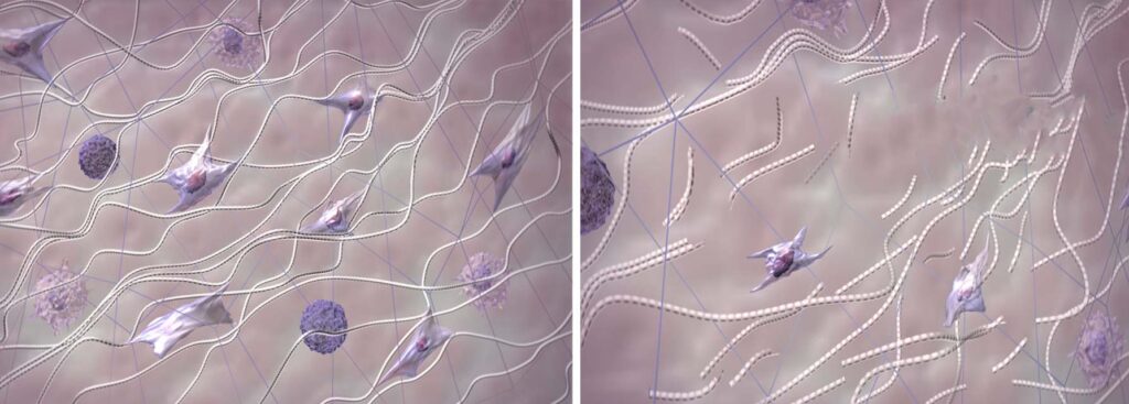 Nærbilder av kollagenfiber i ung vs gammel hud