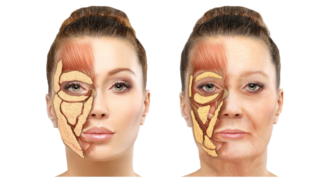 Volumtap i ansiktet ved aldring